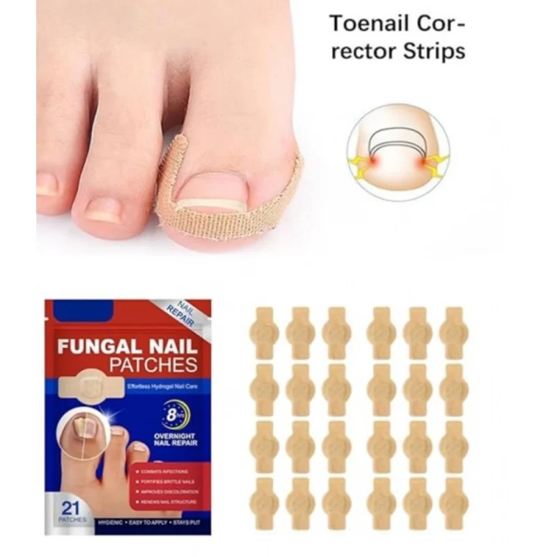 Fungal Nail Patches (Yellow) - Image 5