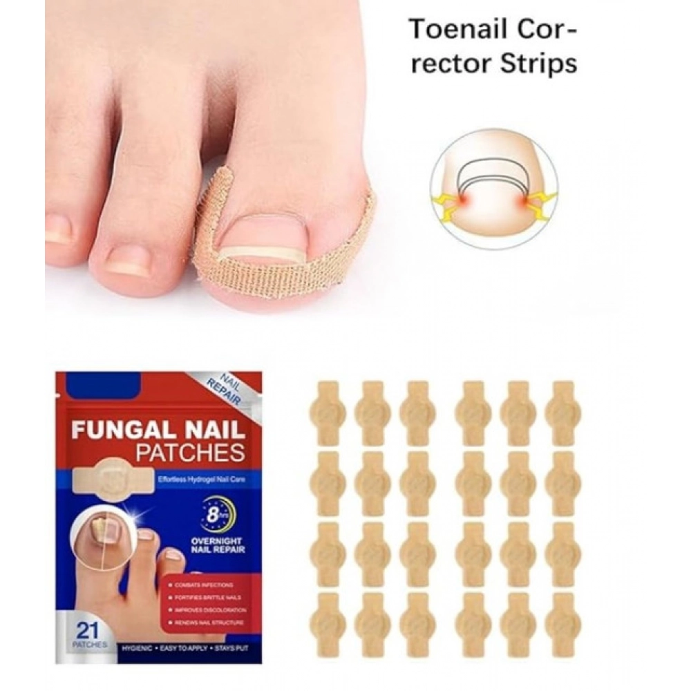 Fungal Nail Patches (Yellow) - Image 5