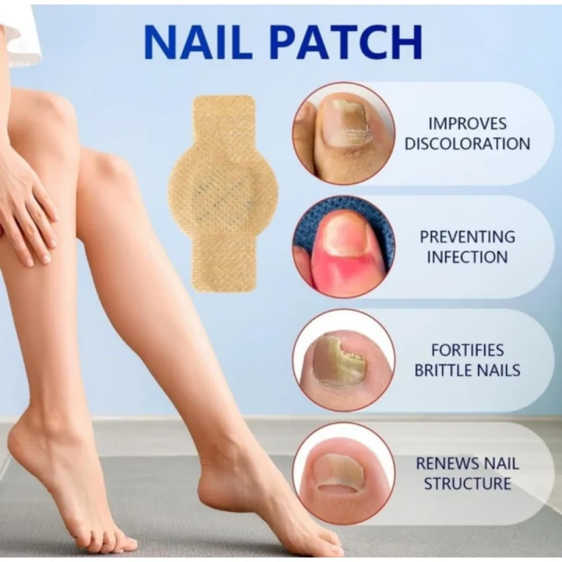 Alternative view of Fungal Nail Patches (Yellow)