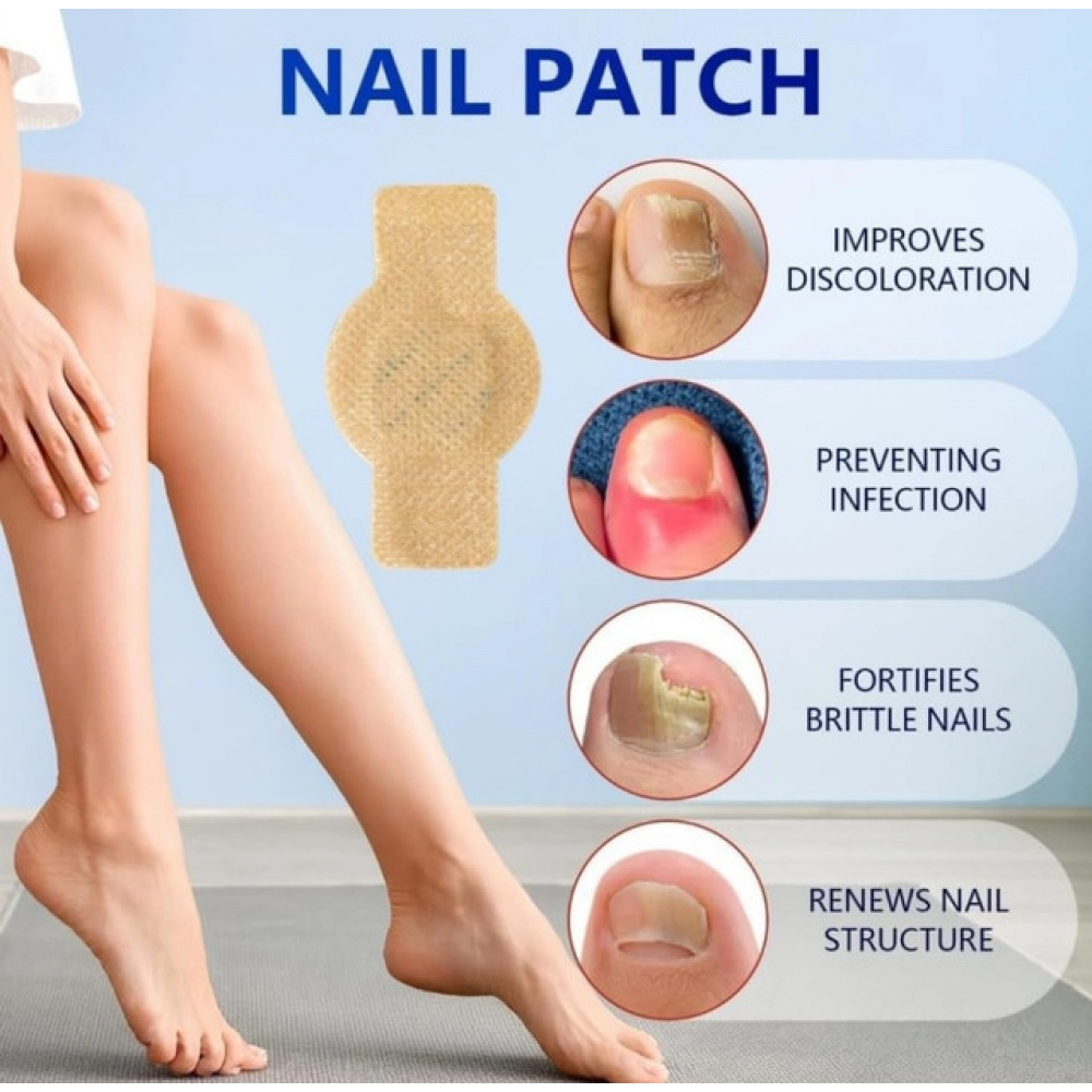 Fungal Nail Patches (Yellow) - Image 2