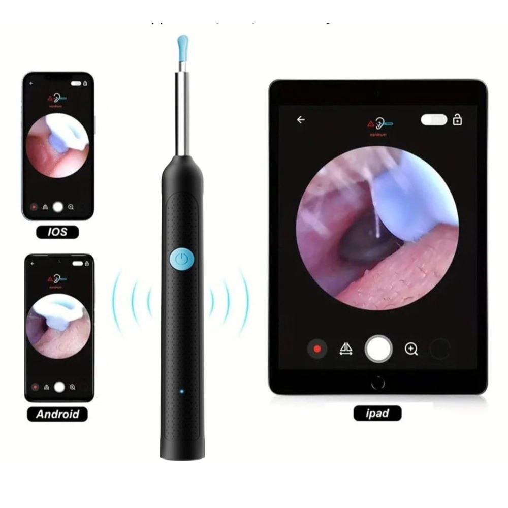 Earwax Cleaner With Camera (Multicolor )
